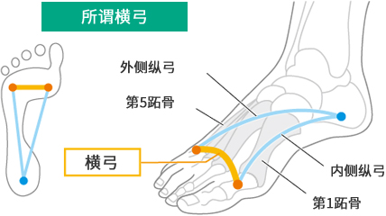 所谓横弓