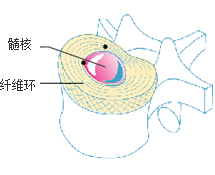 髓核 纤维环